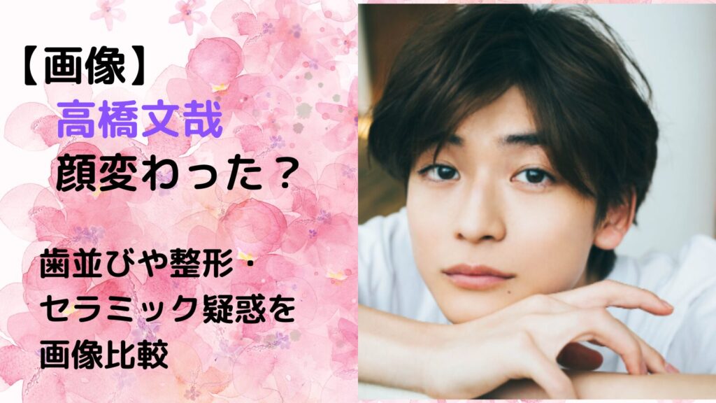 高橋文哉は顔変わった？歯並びや整形・セラミック疑惑を画像比較